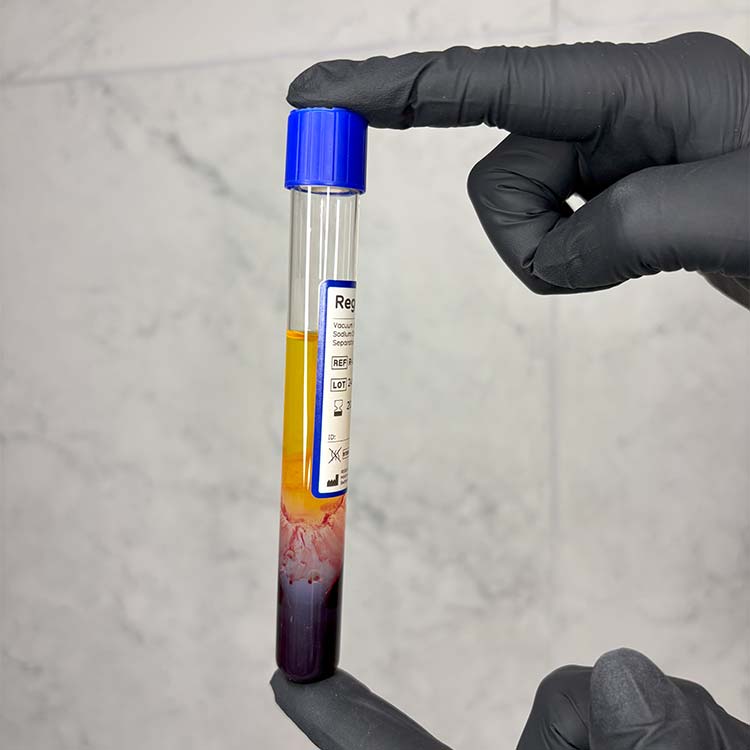 PRP - Plasma Riche en Plaquettes